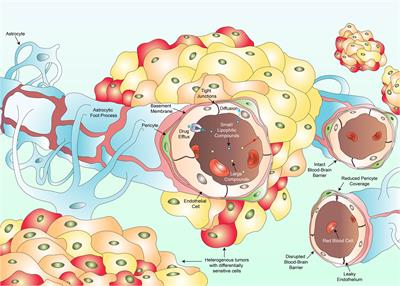 Therapeutically targeting the unique disease landscape of pediatric high-grade gliomas